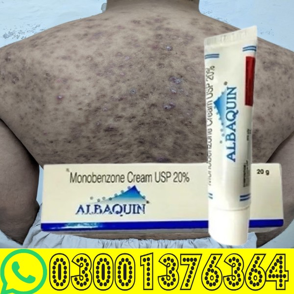 Benoquin Monobenzone Cream Price in Pakistan | 03001376364 | Sale - Image 2