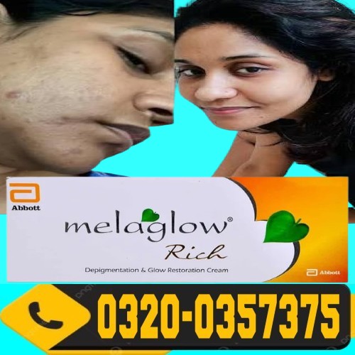 Melaglow Rich Cream Price in Hyderabad / 0320-035375 / Oder Now